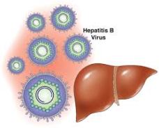 cara mengobati Hepatitis B